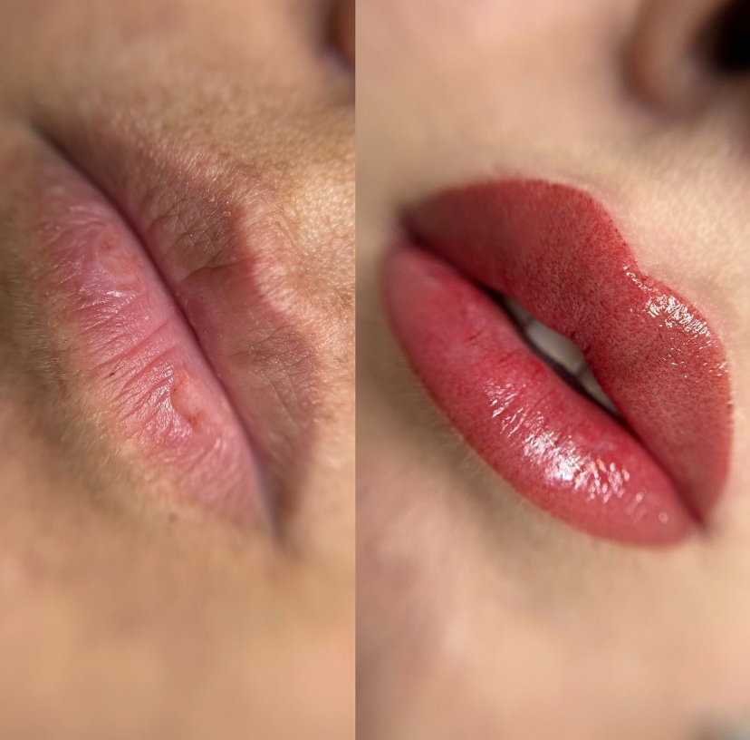 PROMO Microlips
